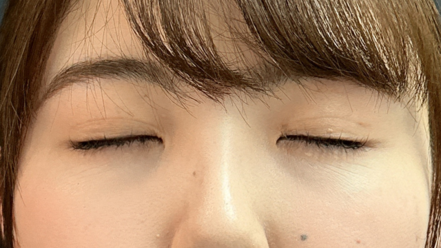 Postoperative Condition Part 1