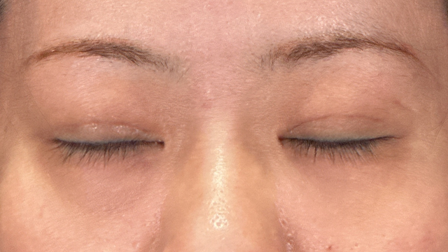 Postoperative Condition Part 1