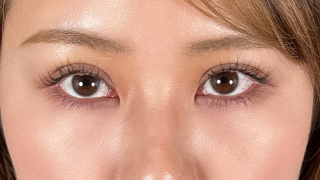 手术前的状态 其一