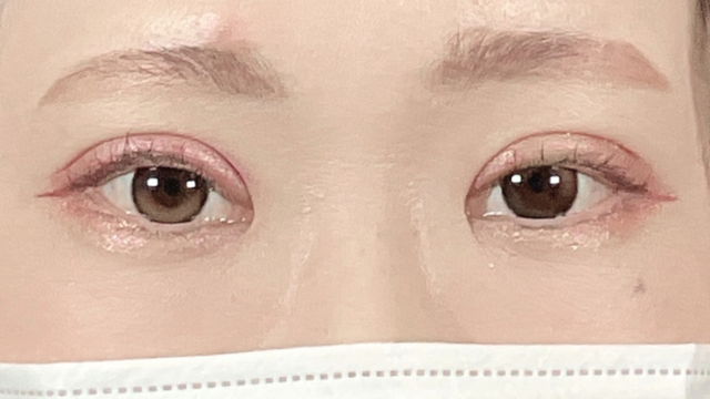 手术前的状态 其一