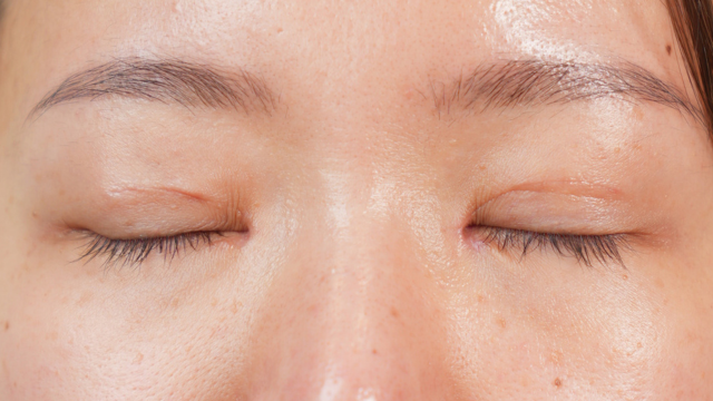 手術前の状態 その1