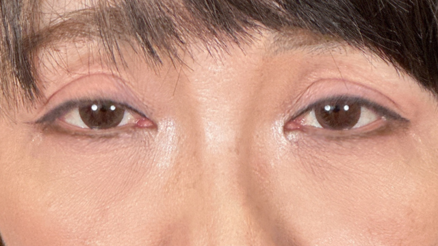 手术前的状态 其一