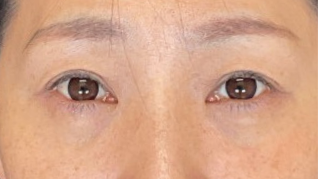 手术前的状态 其一