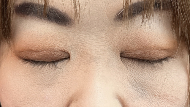 手术前的状态 其一