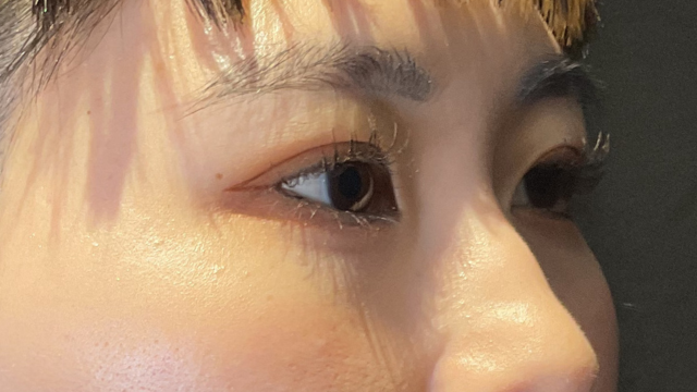 手术前的状态 其一