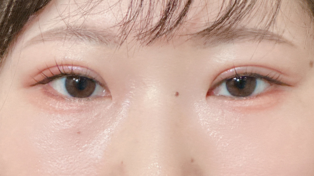 手术前的状态 其一