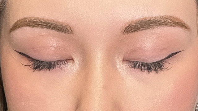 手术前的状态 其一