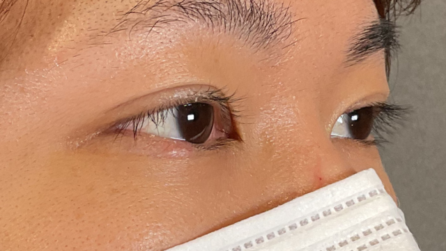 Postoperative Condition Part 1