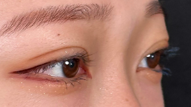 手術前の状態 その1