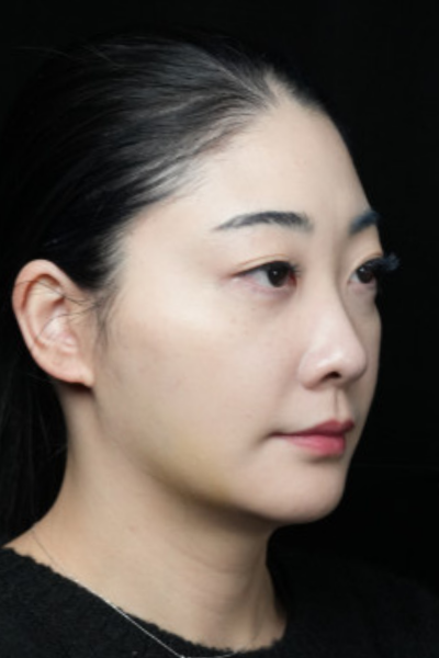 手术前的状态 其一