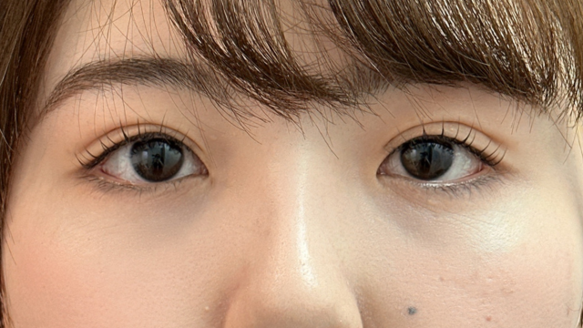 Postoperative Condition Part 1