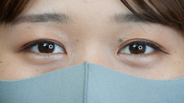 手術前の状態 その1