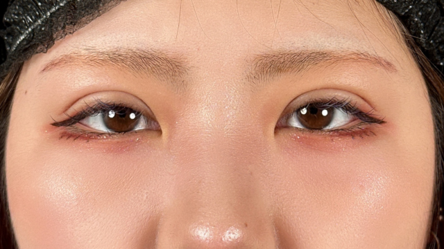 手术前的状态 其一