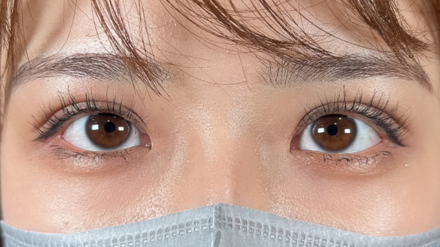 手术前的状态 其一