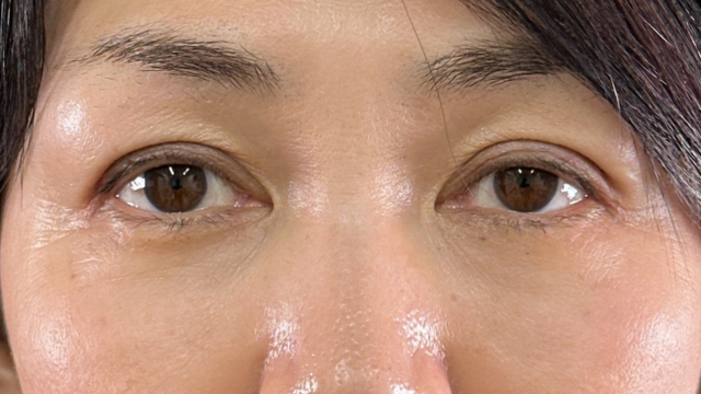 手术前的状态 其一