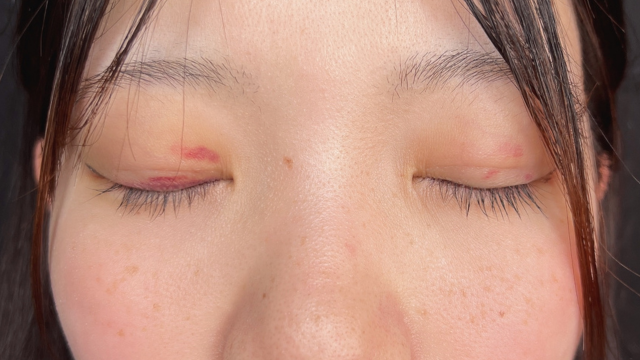 手术前的状态 其一