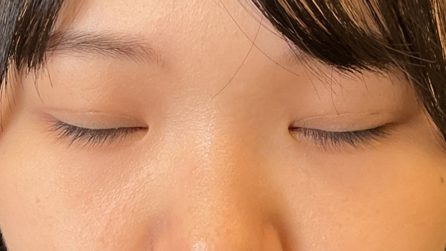 Postoperative Condition Part 1