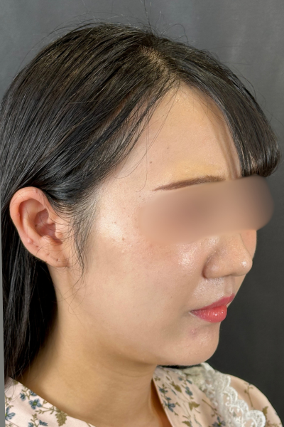 手術前の状態 その1