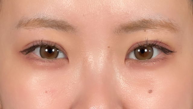 Postoperative Condition Part 1