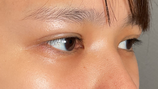 手術前の状態 その1