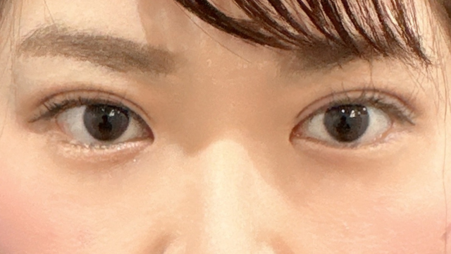 手术前的状态 其一