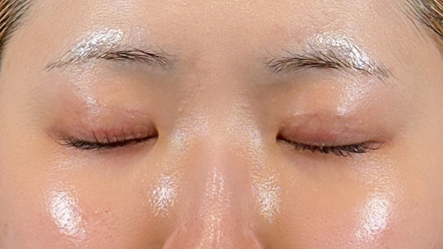 手術前の状態 その1