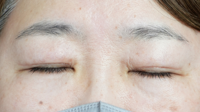 Postoperative Condition Part 1