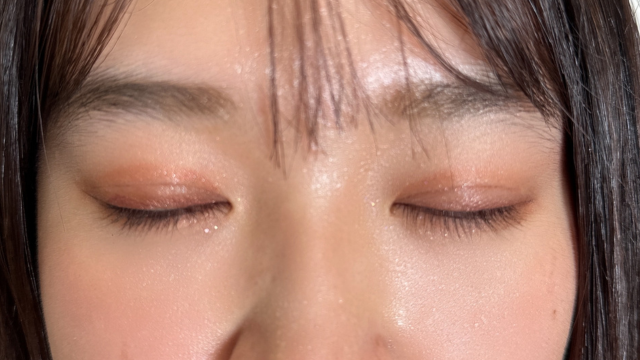 手术前的状态 其一