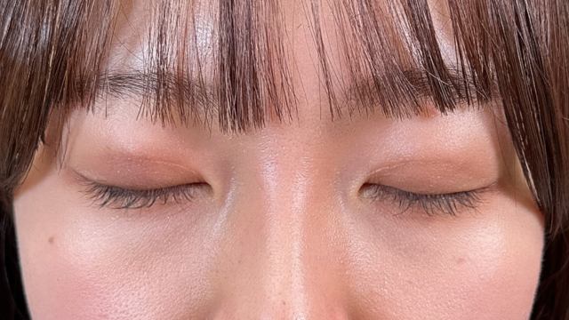 手术前的状态 其一