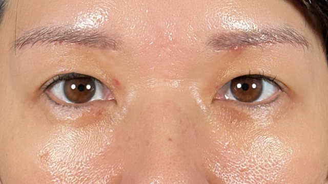 Postoperative Condition Part 1