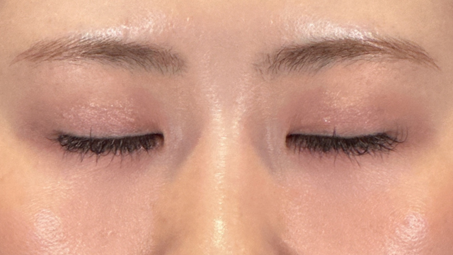 手术前的状态 其一