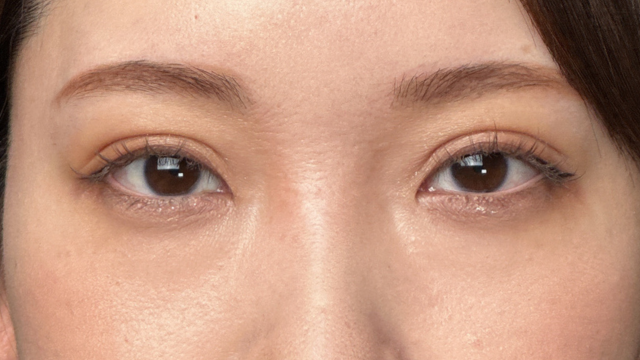 Postoperative Condition Part 1