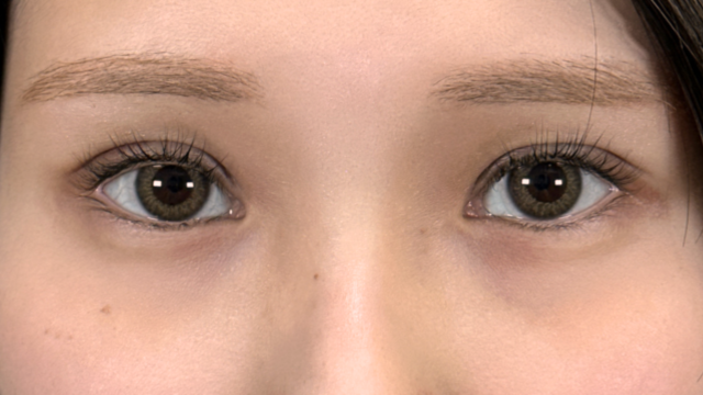 手术前的状态 其一