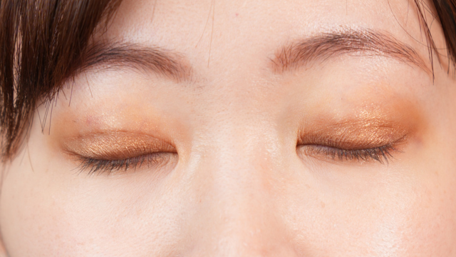 手術前の状態 その1