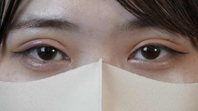 手术前的状态 其一