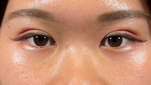 手术前的状态 其一