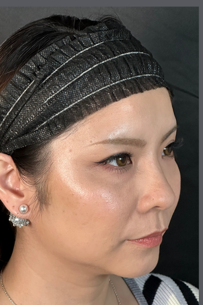 手术前的状态 其一