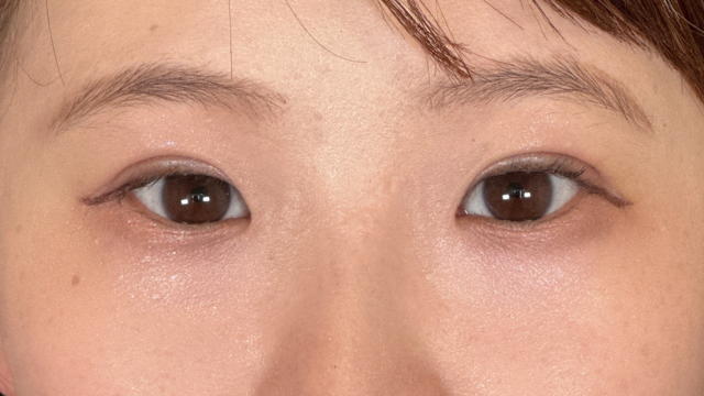 Postoperative Condition Part 1