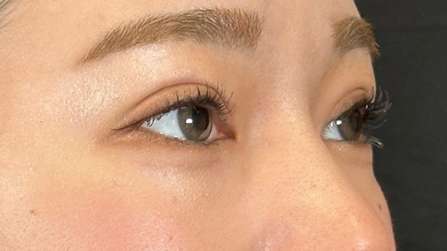 手術前の状態 その1