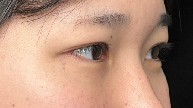 Postoperative Condition Part 1