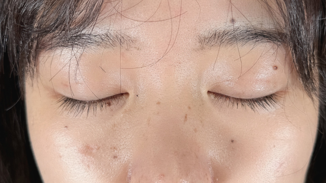 手术前的状态 其一