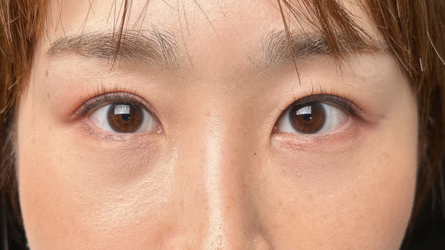 手术前的状态 其一