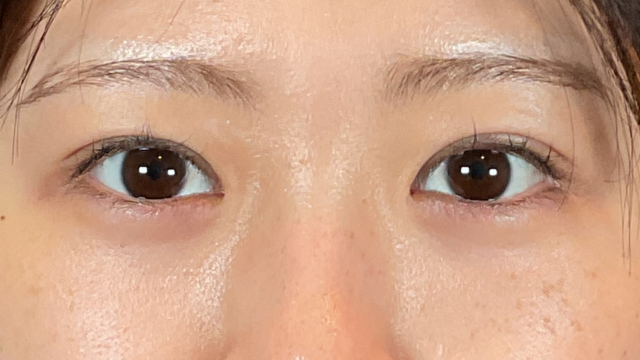 手术前的状态 其一