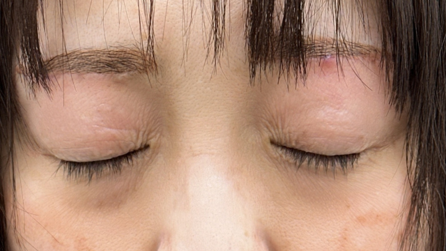 Postoperative Condition Part 1