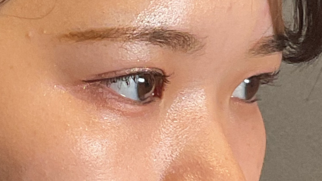 手術前の状態 その1