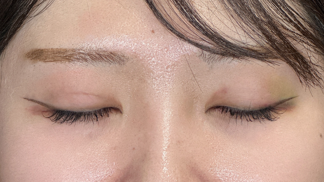 手术前的状态 其一