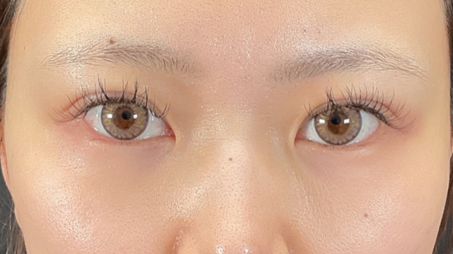 手术前的状态 其一