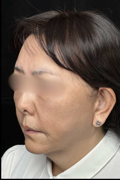 手術前の状態 その1