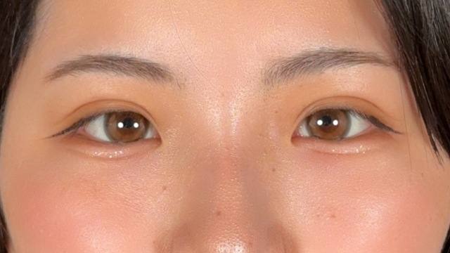 手术前的状态 其一