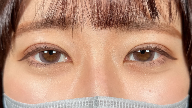 手术前的状态 其一